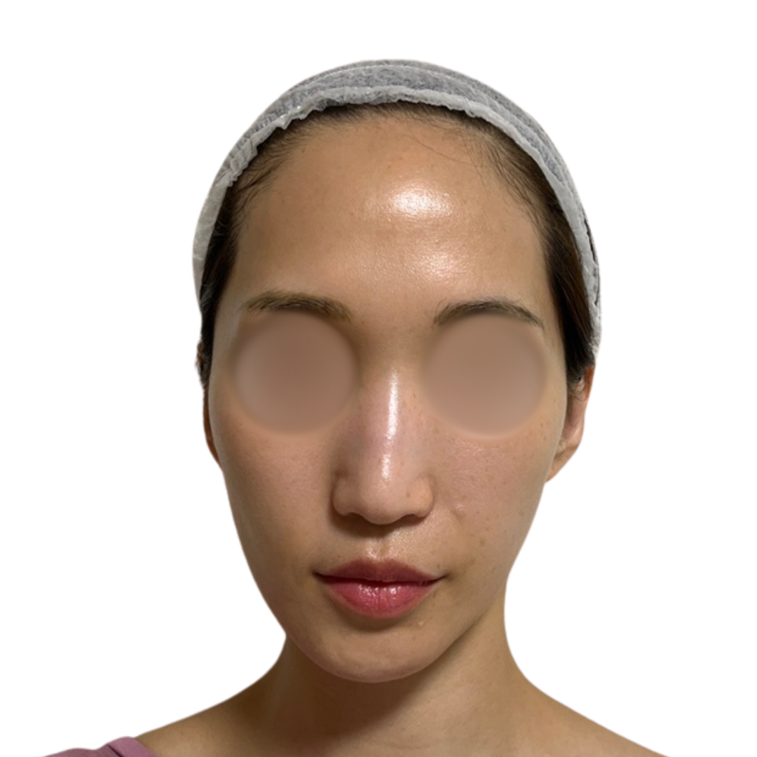 パーティーリフト（スマスアップネオ）